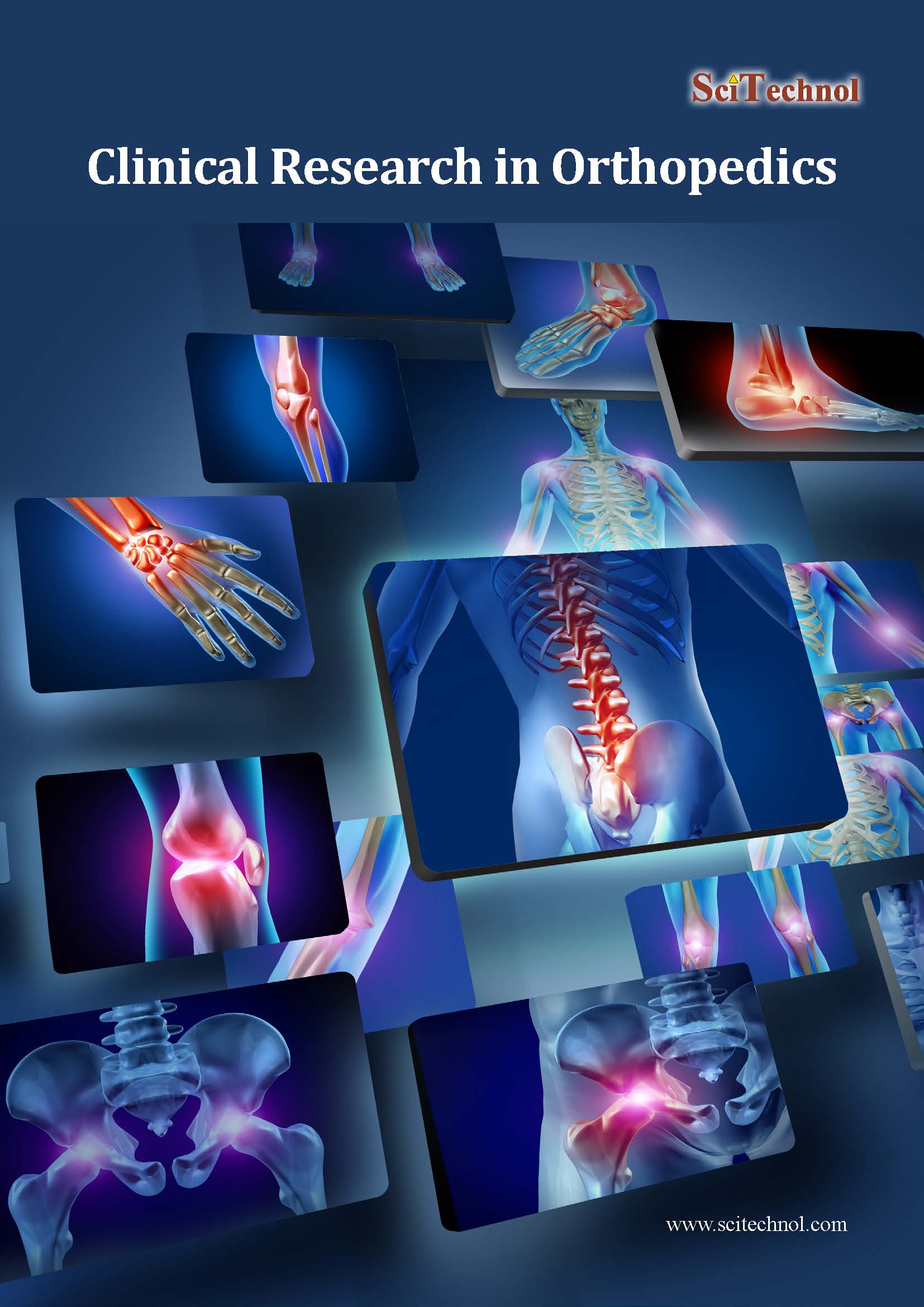 Orthopedics Research | Clinical Journals | Bone Research