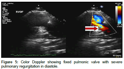 clinical-images-case-reports-pulmonic-valve