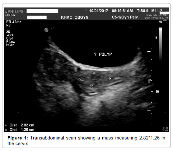 genital-system-disorders-transabdominal-scan