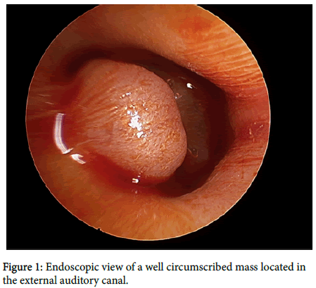 otology-rhinology-Endoscopic-view