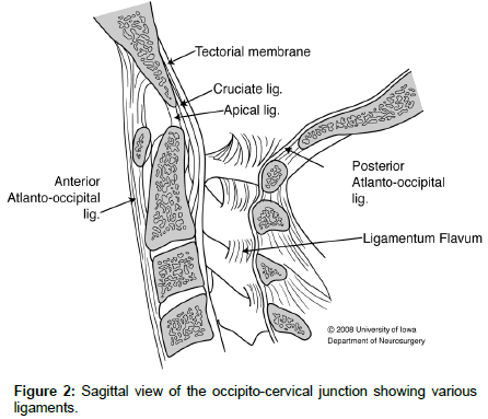 spine-neurosurgery-Sagittal-view