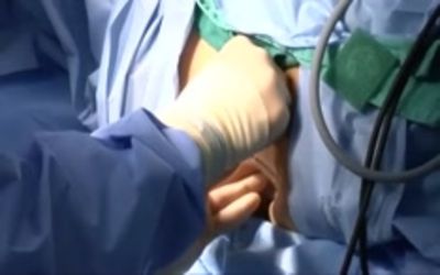 Laparoscopic Power Morcellation and Gynecologic Surgery: Lets Not Jump to Conclusions