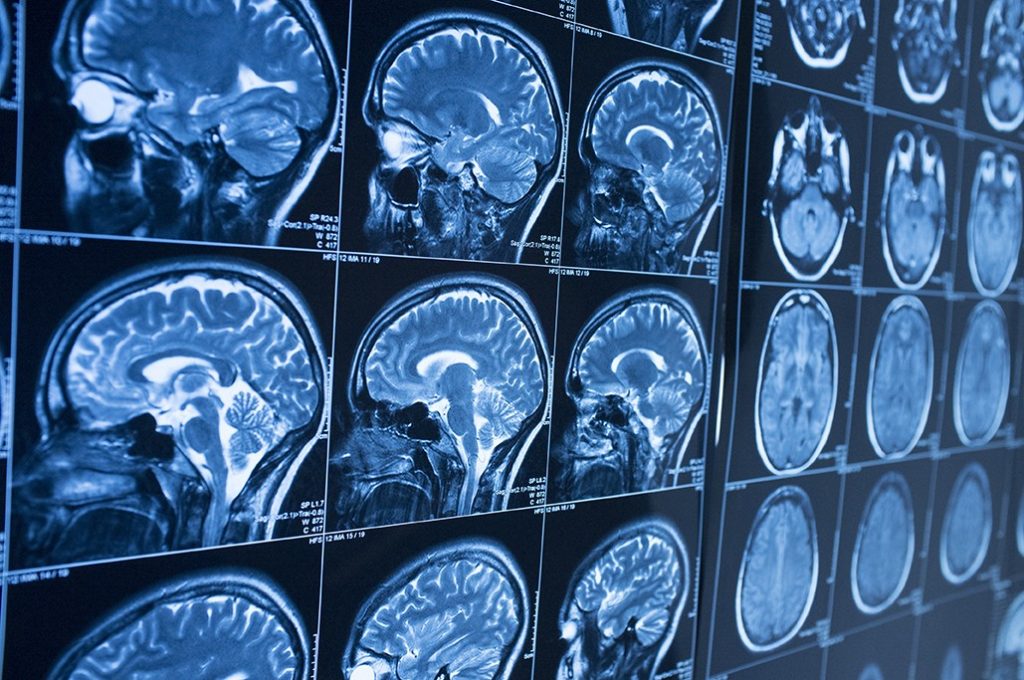 Artificial Intelligence in Medical Imaging