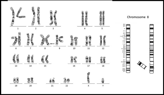 A Rare Familial Paracentric Inversion in the Long Arm of Chromosome 8: Case Report and Review of the Literature