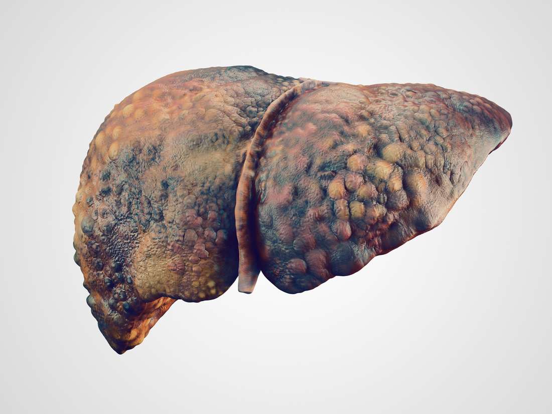 Short Communication on Liver
cancer