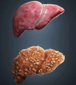 What is The Liver pathophysiology ?